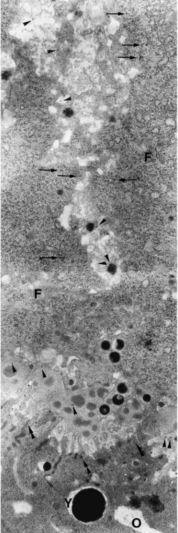 Fig. 4.Immunocytochemistry of S7 oocytes with anti-cathepsinserum. Both the main body of yolk spheres and the periphery regionsas well as heterogeneous granules (arrows) show speciﬁc label.×15,000.