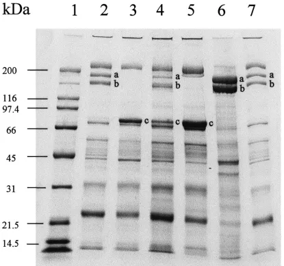 Fig. 1.SDS–PAGE 4–15% gradient gel of proteins from the hemolymph or ovarian extract ofconditions for 25 or 45 days after treatment