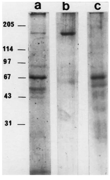 Table 3Electrophoretic pattern of salivary fractions collected after exposure of
