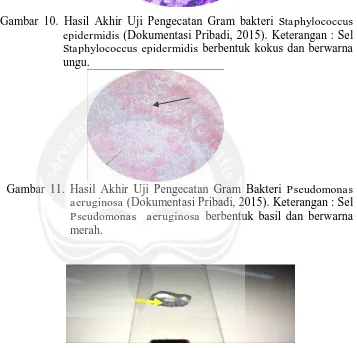 Gambar 10. Hasil Akhir Uji Pengecatan Gram bakteri Staphylococcus  epidermidis (Dokumentasi Pribadi, 2015)