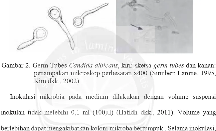 Gambar 2. Germ Tubes Germ Tububess Candida albicansCandida albicans, kiri: sketsa , kikiriri: sksketetsa germ tubesg dan kanan: 