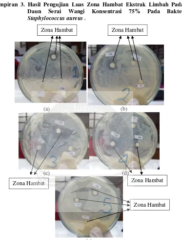 Gambar 33. Zona hambat ekstrak kloroform limbah daun serai wangi konsentrasi (e) 75 % terhadap bakteri Staphylococcus aureus  (a) Ulangan pertama, (b) Ulangan kedua, (c) Ulangan ketiga, (d) Ulangan keempat dan (e) Ulangan kelima (Dokumentasi pribadi, 2015)