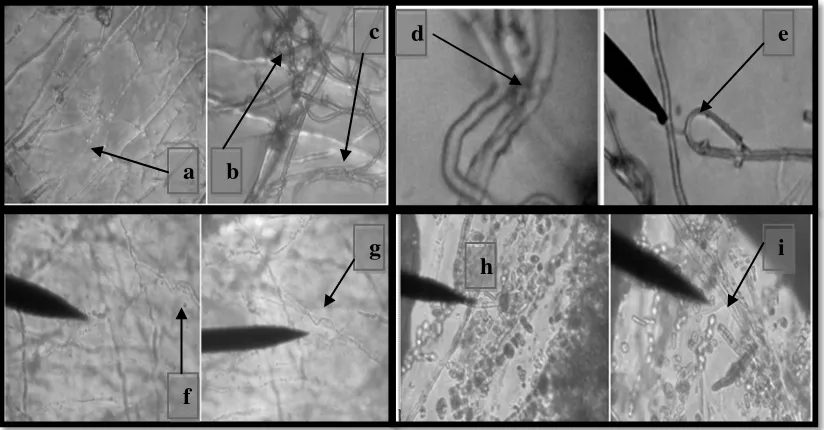 Gambar. 4.4.1.  Hifa abnormal fungi R. microporus (a). Hifa lisis, (b). Hifa menggulung