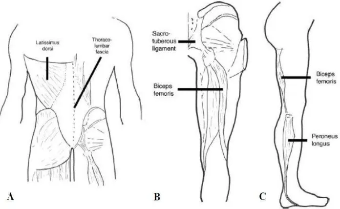 Gambar 4.Koneksi otot Hamstring A. TLF serta Latisimus Dorsi secara Fungsional terhubung dengan bahu dan punggung belakang atas