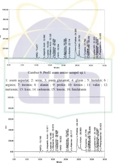 Gambar 9. Profil asam amino sampel uji 1 