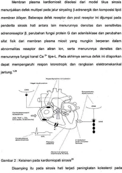 Gambar 2 : Kelainan pada kardiomiopati sirosis2e