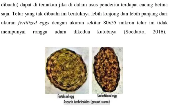 Gambar 1. Telur Ascaris lumbricoides (Nadhiasari, 2014) 