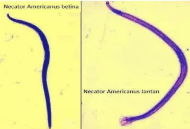 Gambar 8. Cacing Dewasa Necator americanus (Budiman,    2012) 