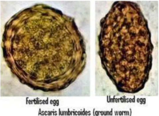 Gambar 2.1 Telur Ascaris lumbricoides (Nadhiasari, 2014) 
