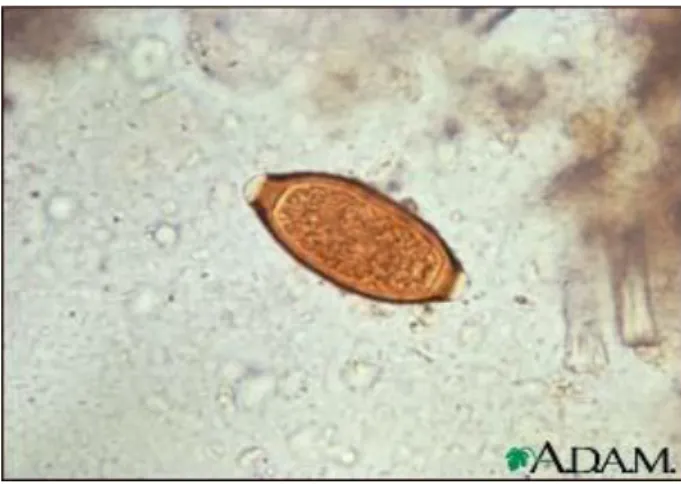 Gambar 2.4 Telur cacing Trichuris trichiura yang berisi embrio (pembesaran   10 x 40)