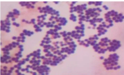 Gambar 2. Pewarnaan bakteri Staphylococcus aureus pada perbesaaran 1000x  (Sumber: Anonim, 2015) 