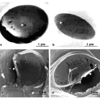 Table 3. Mean pit membrane pore size, membrane damage (largesthole diameter) and water potential at which cavitation begins (basedon the capillary equation of Sperry et al