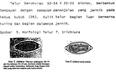 Gambar 5. Mcrfolcgi Telur T, trichiura