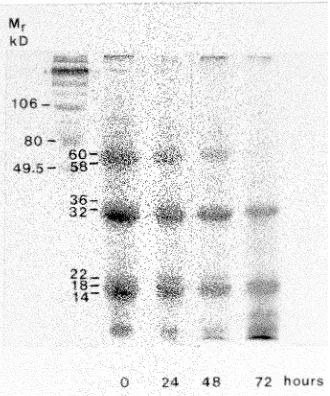 Figure 1. One-dimensional gel electrophoresis of proteins extractedfrom protein (reduced and dissociated) was loaded per lane