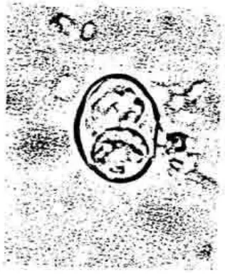 Gambar 1. Ookista Toxoplasma gondiipada tinja kucingsumber: r. Aflas Berwama parasitologi 