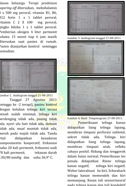 Gambar 3. Audiogram tanggal 27-08-2011. 