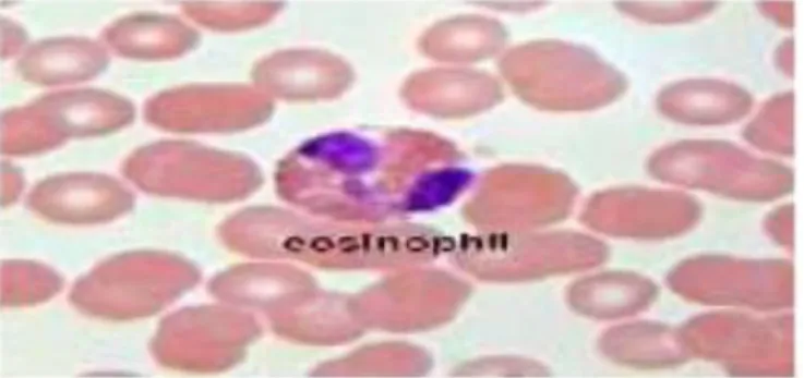 Gambar 2.2 Eosinofil (Barbara, 2014) 