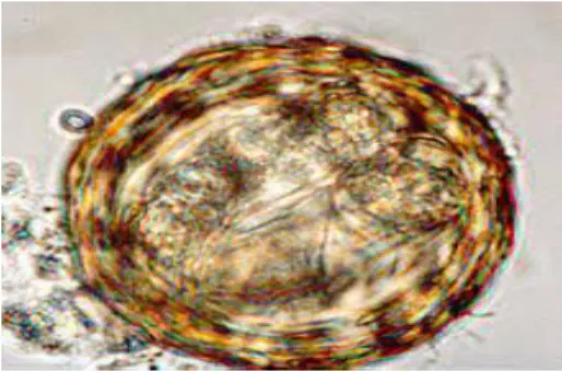 Gambar 2.2 Telur Ascaris lumbricoides fertile  (Sumber : atlas parasitologi kedokteran, 1994) 