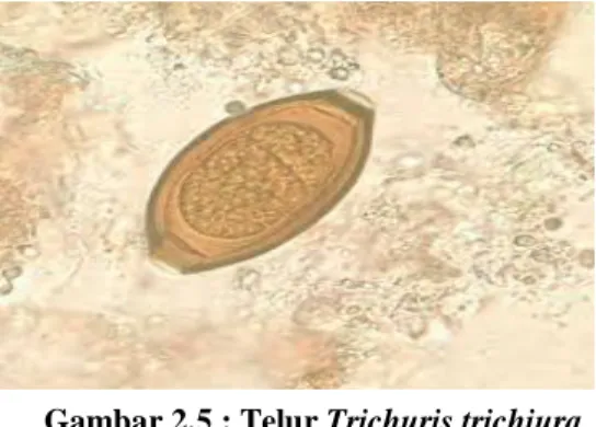 Gambar 2.5 : Telur Trichuris trichiura  (sumber : prianto 2010)