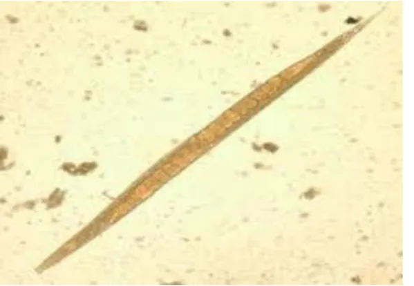 Gambar 2.11 : Cacing dewasa Strongyloides stercoralis betina  (sumber : Onggowaluyo : 2000) 
