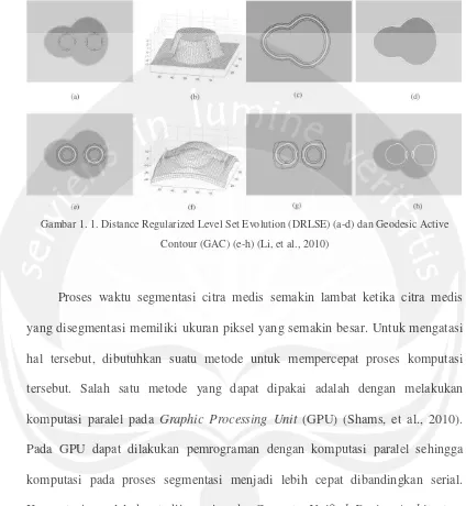 Gambar 1. 1. Distance Regularized Level Set Evolution (DRLSE) (a-d) dan Geodesic Active 