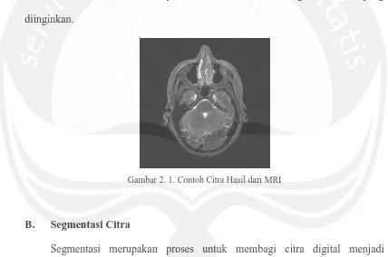 Gambar 2. 1. Contoh Citra Hasil dari MRI 