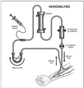 Gambar 2.3 - Diagram hemodialisis (National Kidney Foundation, 2007) 