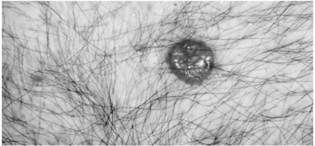 Figure 2.1 Sample exam photograph. This image can be found in color in the app.
