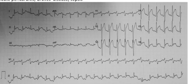 The Role of Synchronized Electrical Cardioversion vs Pharmacological ...