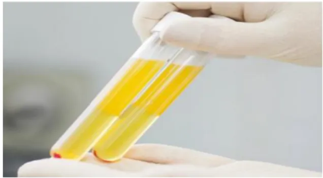 Gambar 2.4. Plasma Darah (16) 5.  Whole Blood 