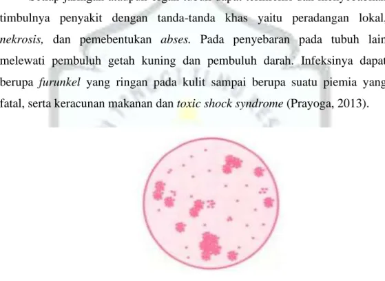 Gambar 2.2. Morfologi Staphylococcus aureus (Vasanthakumari, 2007)  Klasifikasi bakteri S