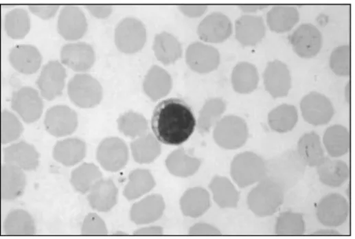 Fig. 1. A blood lymphocyte. Reproduced from Immunology 4th edn, Roitt, Brostoff and Male, with permission from Mosby.