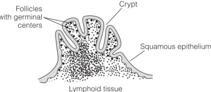 Fig. 1. Tonsilar lymphoid tissue: Antigens trapped in the crypts are transported by M cells into the sub-epithelial areas where lymphocytes are stimulated via antigen presenting cells.