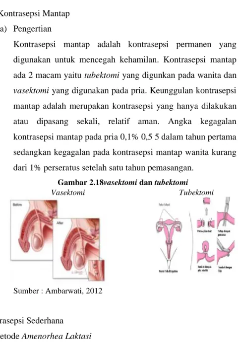 Gambar 2.18vasektomi dan tubektomi 