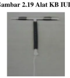 Gambar 2.19 Alat KB IUD