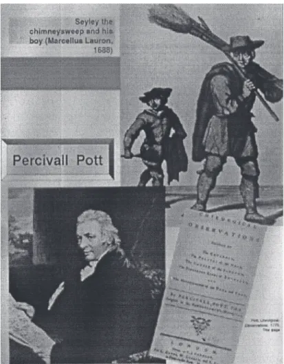 FIGURE 2-2 In 1775, Dr. Percivall Pott, a British surgeon, reported one of the earliest observations on environmental cancer