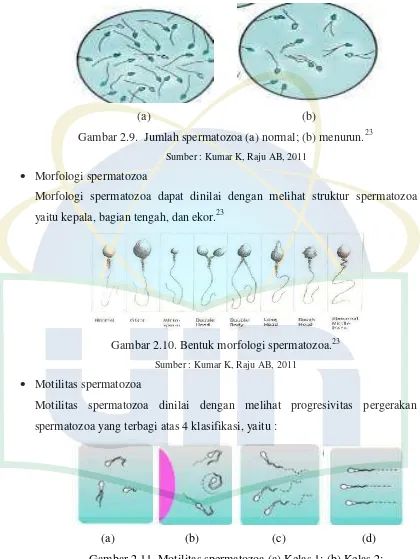 Gambar 2.11. Motilitas spermatozoa (a) Kelas 1; (b) Kelas 2;  