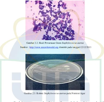 Gambar 2.2. Hasil Pewarnaan Gram Staphylococcus aureus 