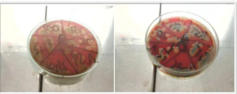 Gambar 9 Pertumbuhan Koloni Bakteri Bacillus cereus pada agar darah 