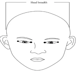 Gambar 2.3. Lebar Kepala (Dikutip dari : Akinbami BO, 2014) 