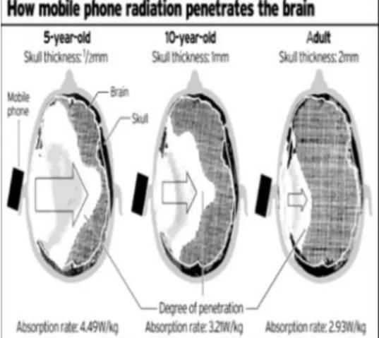 Gambar 1. Radiasi Ponsel pada Otak  Manusia pada Anak dan Dewasa. 9