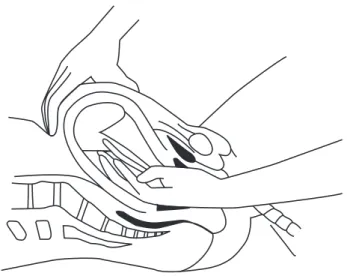 Figure 6.5  Removal of the placenta