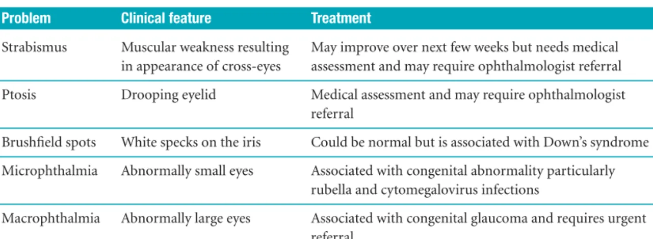 Table 4.1    Neonatal eye abnormalities
