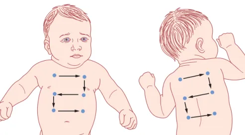 Figure 4.4    Areas of auscultation of the chest. (Reproduced from Tappero EP, Honeyﬁeld ME (2003) Physical Assessment of the Newborn