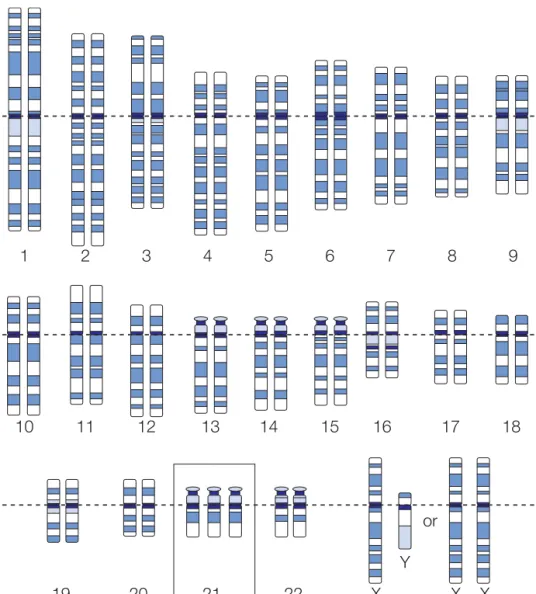 Figure 5.3    Trisomy. (Courtesy: National Human Genome Research Institute)