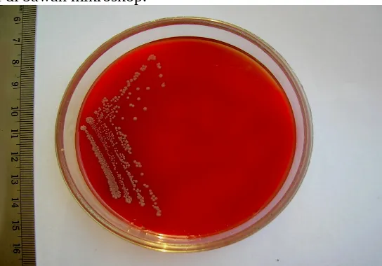 Gambar 2. Identifikasi salah satu bakteri  Staphylococcus sp dengan                   Pewarnaangram yang di lihat di bawah mikroskop.