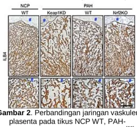 Gambar 2. Perbandingan jaringan vaskuler  plasenta pada tikus NCP WT,  PAH-Keap1KD, PAH-WT, dan PAH-Nrf2KO [20]