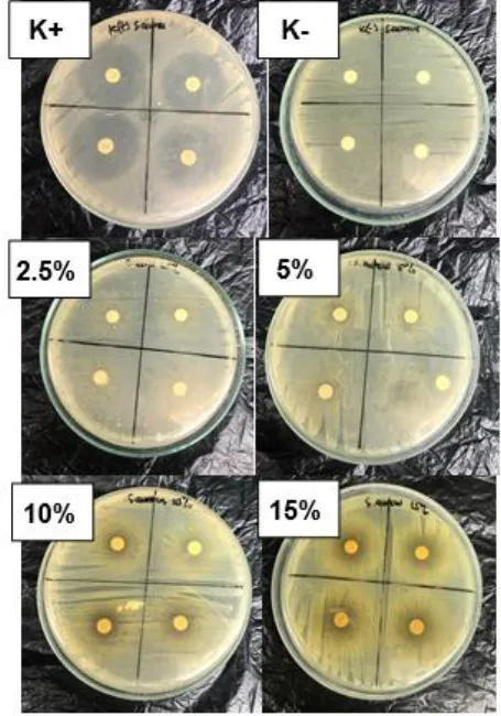 Gambar 5.  Zona hambat  pertumbuhan  koloni bakteri S. typhi 