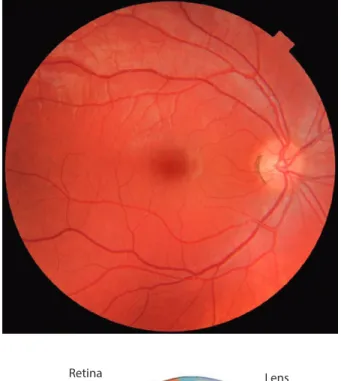 . Fig. 4.3  Illustration showing  main structures of the eye  including the fovea. 