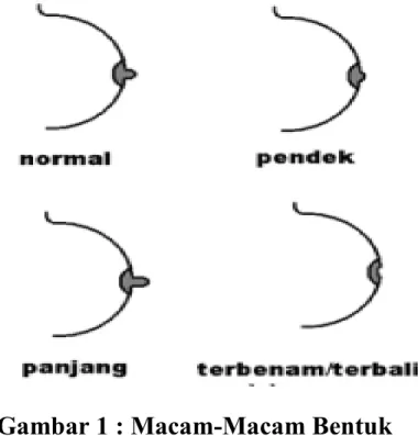 Gambar 1 : Macam-Macam Bentuk  Puting 